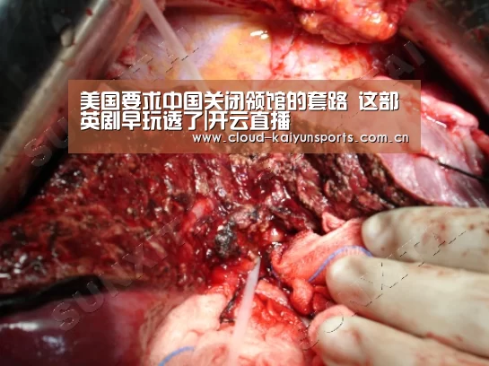 美国要求中国关闭领馆的套路 这部英剧早玩透了|开云直播(图2) 开云体育首页